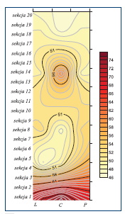 Rys.11.
Rozkład minimalnej temperatury powietrza
w płaszczyźnie wypływu powietrza suszącego
w suszarni typu SDGG20 z zastosowanym odzyskiem
ciepła z powietrza wywiewanego dla temperatury
palnika 130o C